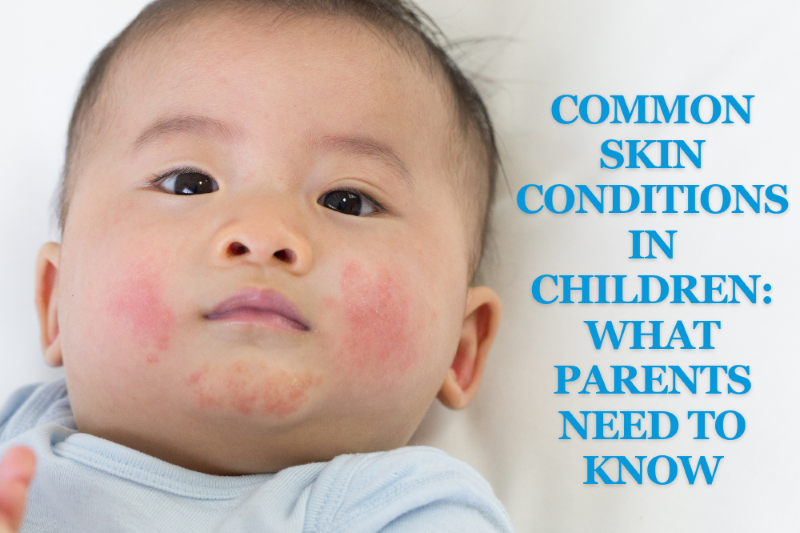 Common Skin Conditions in Children: What Parents Need to Know