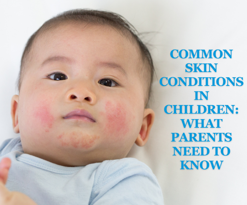 Common Skin Conditions in Children: What Parents Need to Know